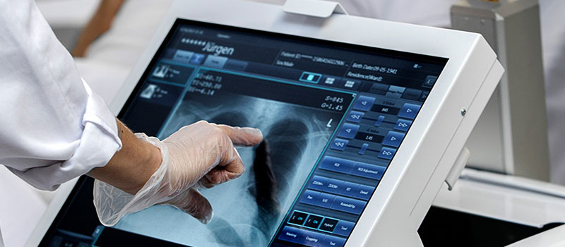 Portable X-Ray in Mumbai Portable X-Ray in Mumbai